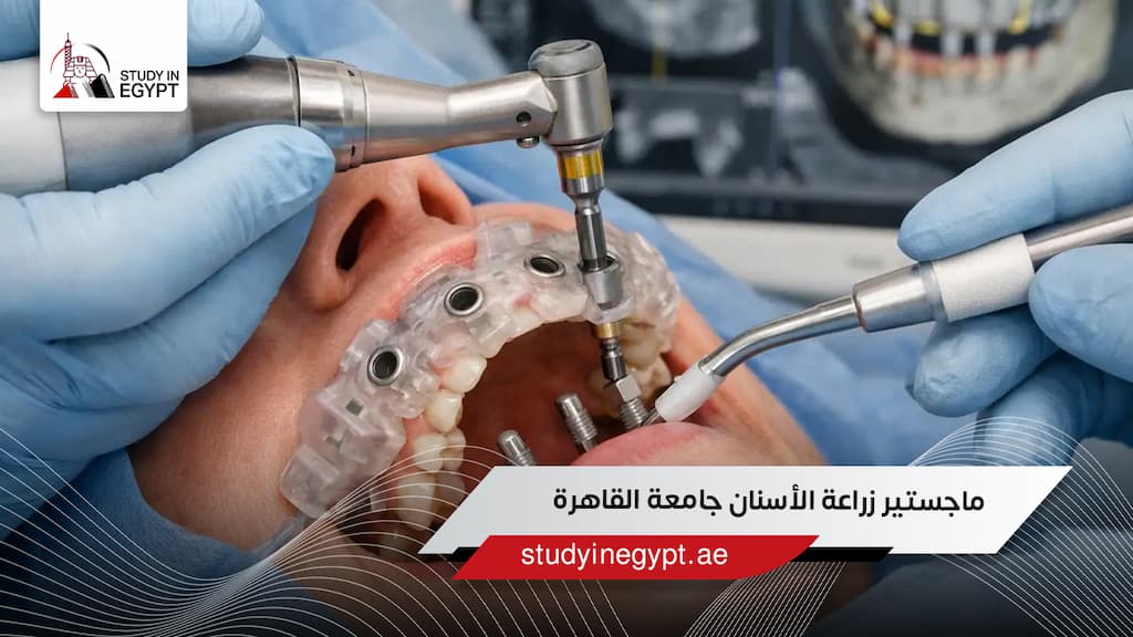 ماجستير زراعة الأسنان جامعة القاهرة